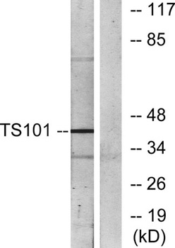 Tsg 101 rabbit pAb