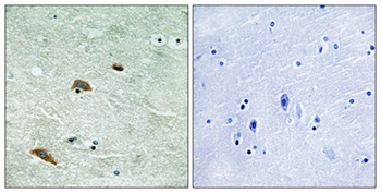 TTK (phospho Thr676) rabbit pAb