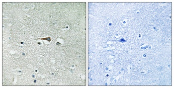 TTK rabbit pAb Antibody
