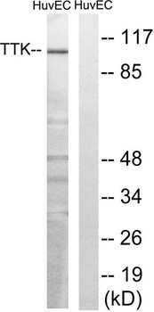 TTK rabbit pAb Antibody