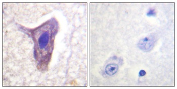 CD88 (phospho-Ser338) antibody