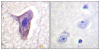 CD88 (phospho Ser338) rabbit pAb