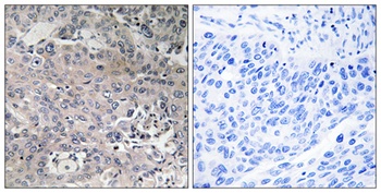 EF-Tu rabbit pAb Antibody