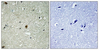 HIRA (phospho Thr555) rabbit pAb