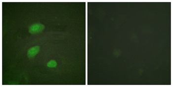 HIRA (phospho Thr555) rabbit pAb