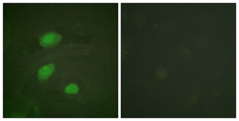 HIRA (phospho-Thr555) antibody