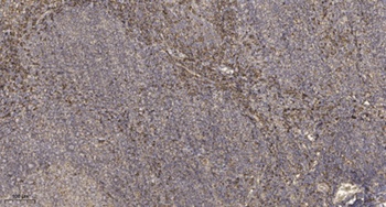 RGPD2/3/4/6/8 rabbit pAb Antibody