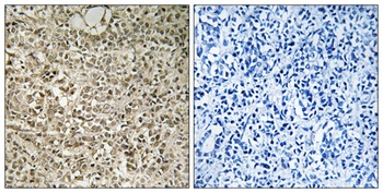 Ribosomal Protein L40 rabbit pAb