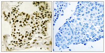 UBF (phospho Ser484) rabbit pAb