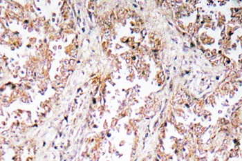 UCP2 rabbit pAb