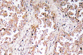 UCP2 antibody