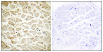 COL14A1 antibody