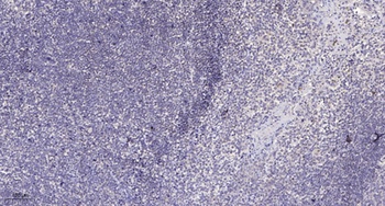 MRP-L49 antibody