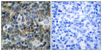 VASP (phospho Ser238) rabbit pAb