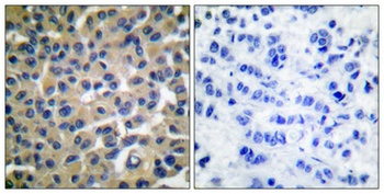 Vav (phospho Tyr174) rabbit pAb