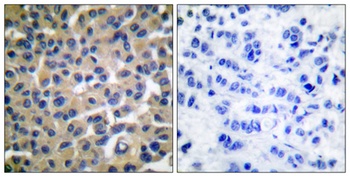 Vav (phospho Tyr174) rabbit pAb
