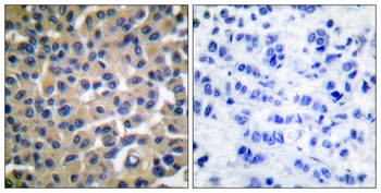 Vav (phospho-Tyr174) antibody