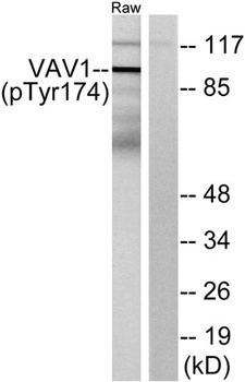 Vav1 (phospho-Tyr174) antibody