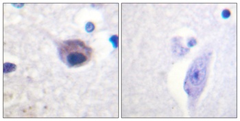 Vav2 (phospho-Tyr142) antibody