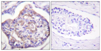Vinculin (phospho Tyr821) rabbit pAb
