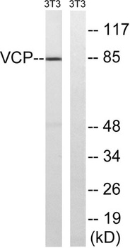 VCP rabbit pAb