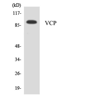 VCP rabbit pAb