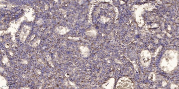 VCP rabbit pAb