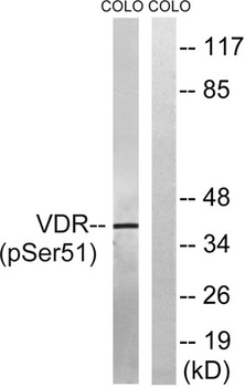 VDR (phospho Ser51) rabbit pAb