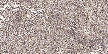 VDR (phospho Ser51) rabbit pAb
