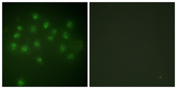 VDR (phospho-Ser208) antibody