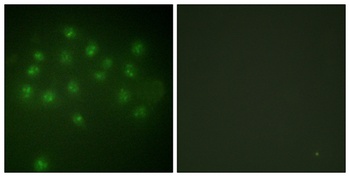 VDR (phospho Ser208) rabbit pAb