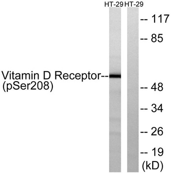 VDR (phospho Ser208) rabbit pAb