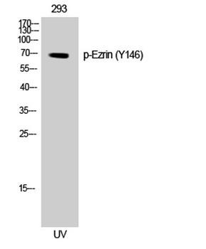 Ezrin (phospho Tyr146) rabbit pAb