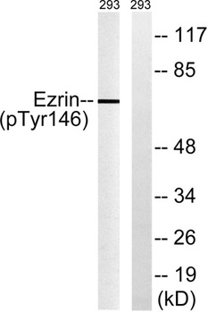 Ezrin (phospho Tyr146) rabbit pAb