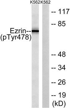 Ezrin (phospho Tyr478) rabbit pAb