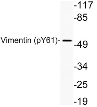 Vimentin (phospho-Tyr61) antibody