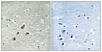 Vimentin (phospho-Ser83) antibody