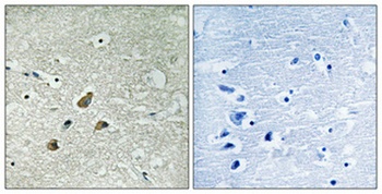 Vimentin (phospho Ser83) rabbit pAb