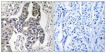 Vimentin (phospho Ser83) rabbit pAb