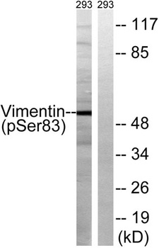 Vimentin (phospho-Ser83) antibody