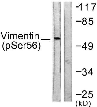 Vimentin (phospho Ser56) rabbit pAb