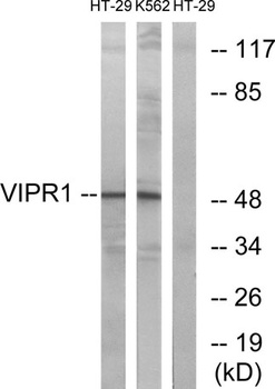 VPAC1 antibody
