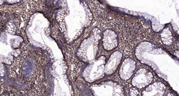 VPAC1 rabbit pAb