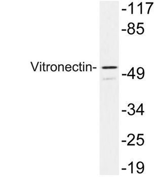 Vitronectin rabbit pAb