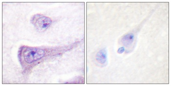 WASP (phospho Tyr290) rabbit pAb