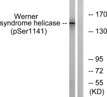 WRN (phospho Ser1141) rabbit pAb