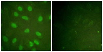 Ku-80 (phospho Thr714) rabbit pAb
