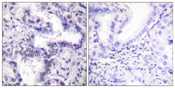 Ku-80 (phospho Thr714) rabbit pAb