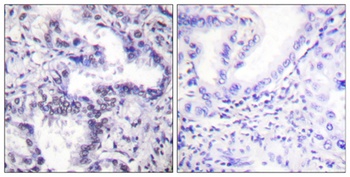 Ku-80 (phospho-Thr714) antibody