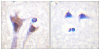 14-3-3 ζ/δ (phospho Thr232) rabbit pAb